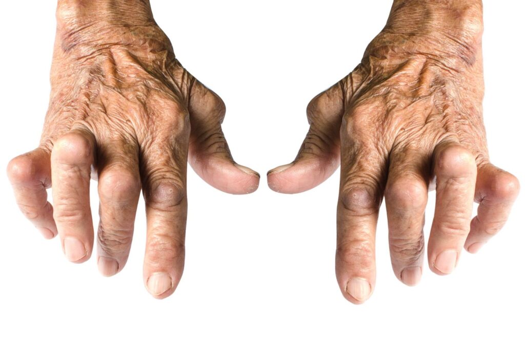 neem oil heals arthritis