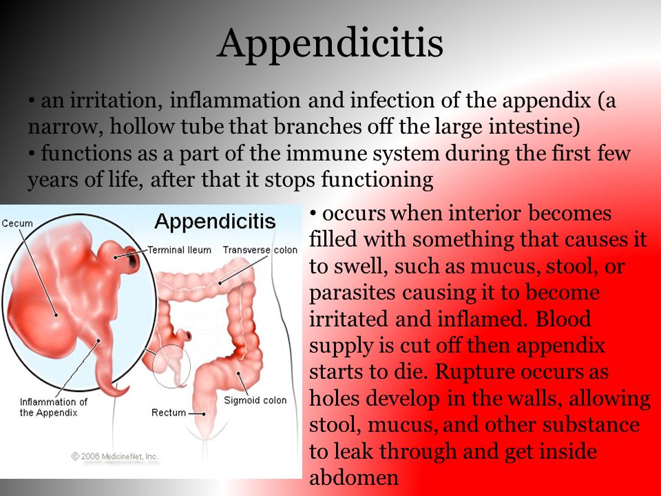 appendix