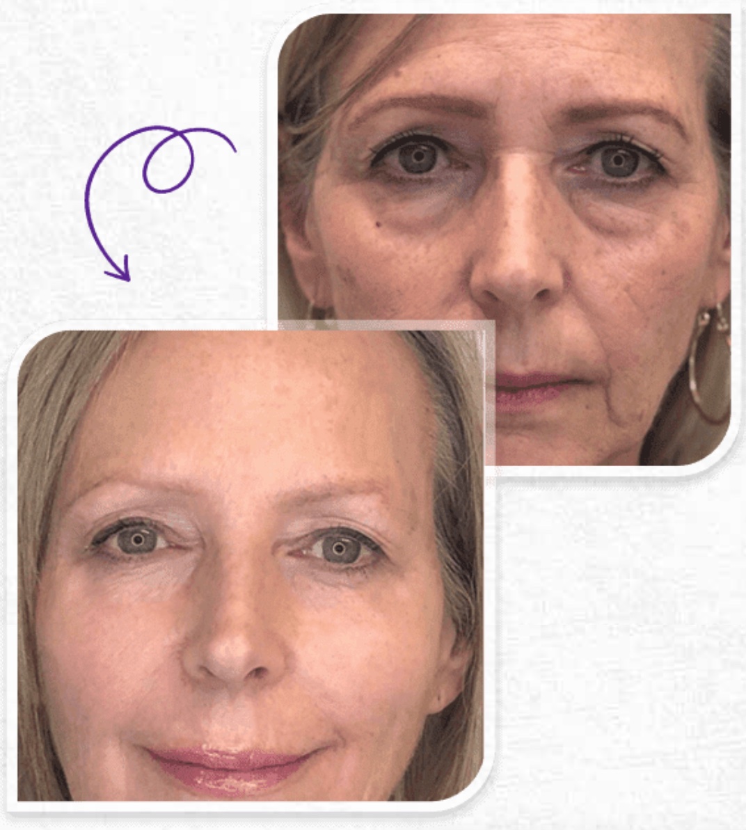 phytoceramides