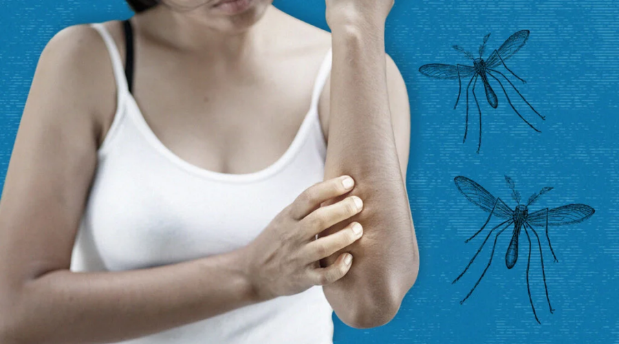 mosquitoes naturally