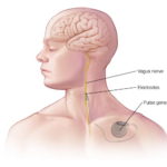 vagus nerve