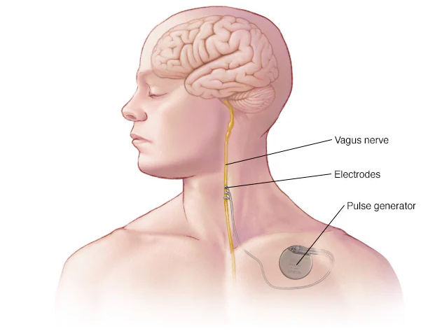 vagus nerve