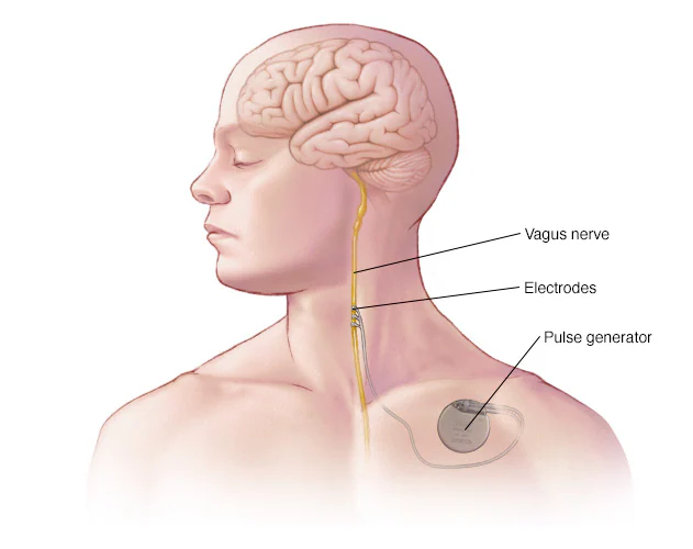 vagus nerve