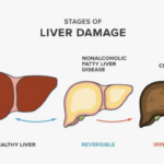 liver