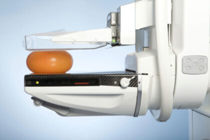 mammograms
