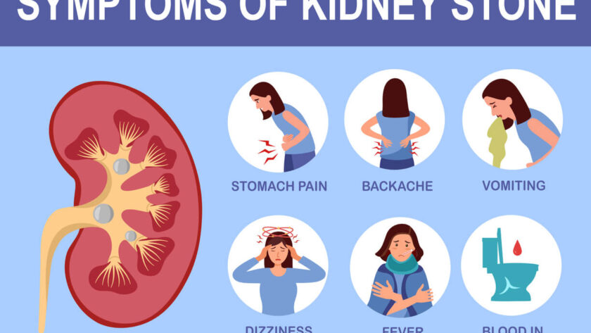 kidney stones