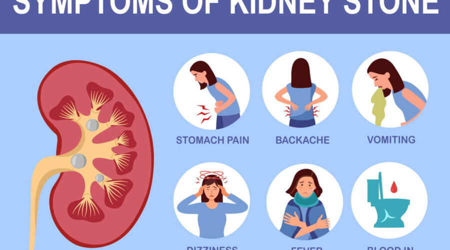 kidney stones