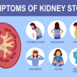 kidney stones