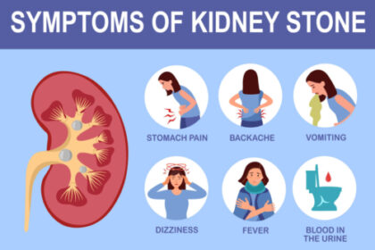 kidney stones