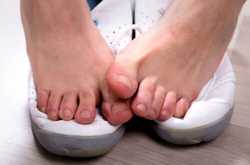 stinky feet
