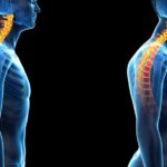 posture