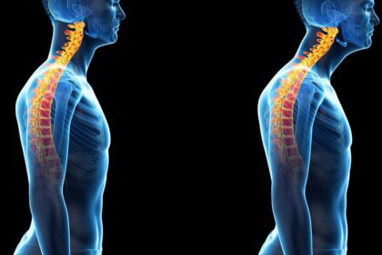 posture