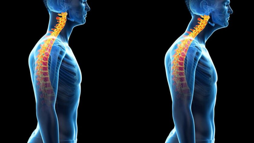 posture