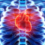 heart disease