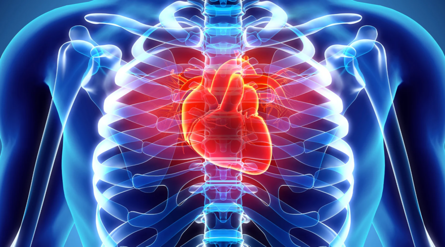 heart disease