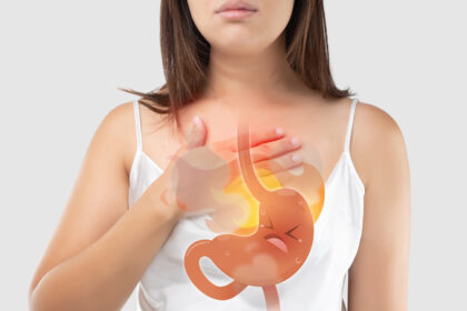 acid reflux
