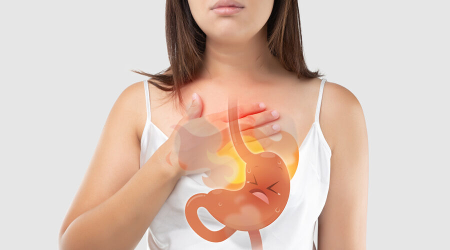 acid reflux