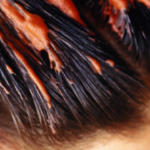 hair dye