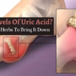 uric acid