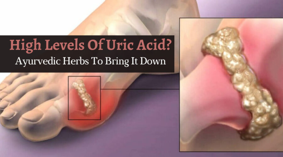 uric acid